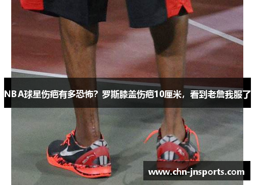 NBA球星伤疤有多恐怖？罗斯膝盖伤疤10厘米，看到老詹我服了